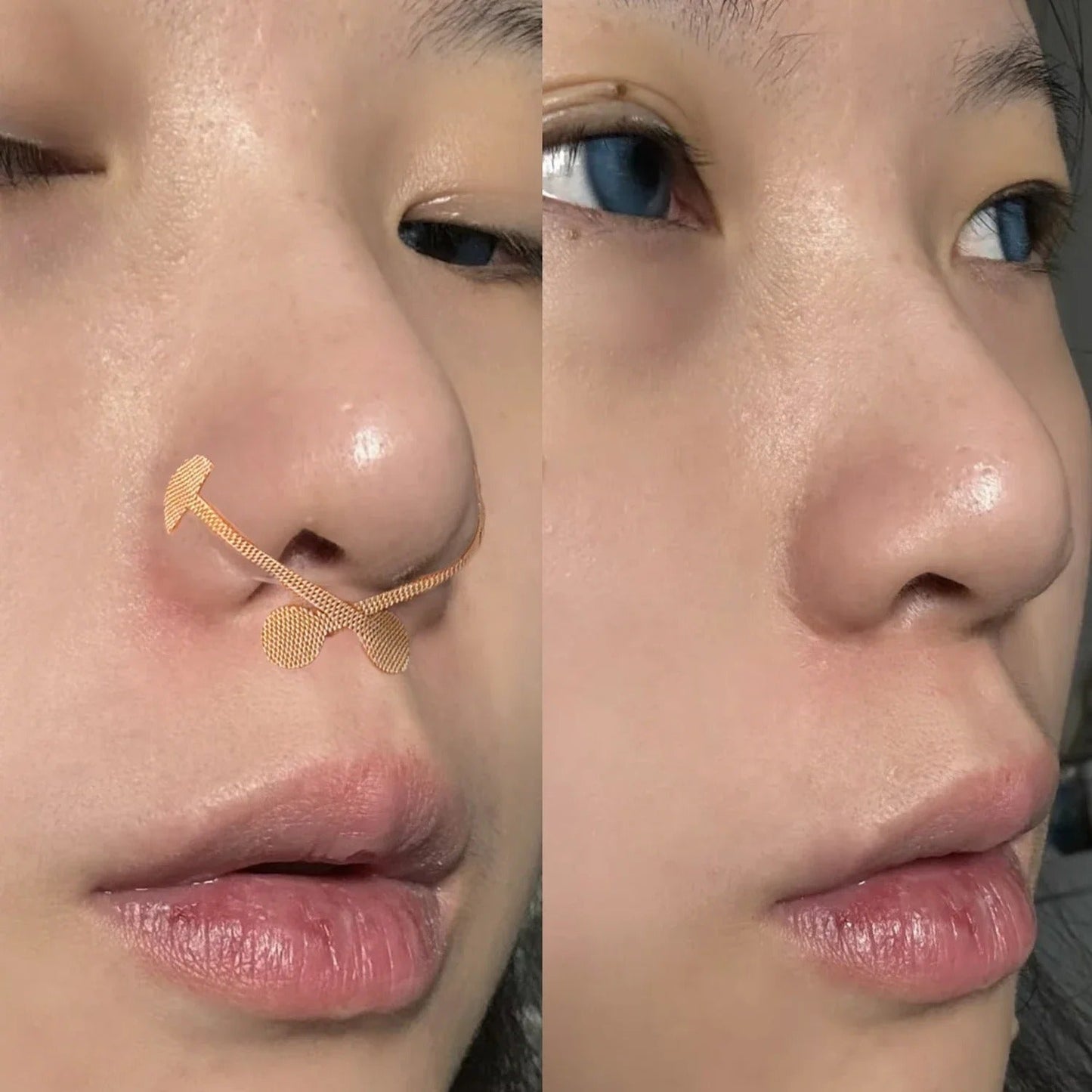 Contouring Corrective Nose Patch
