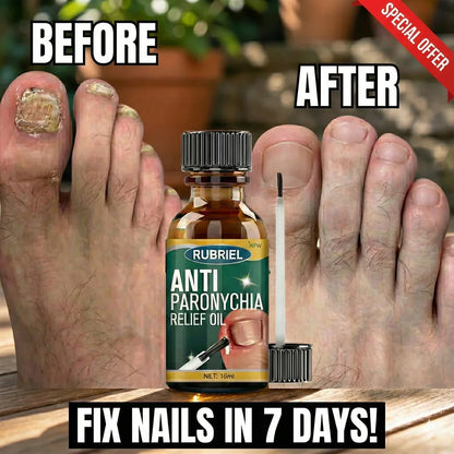 Anti Paronychia Relief Oil
