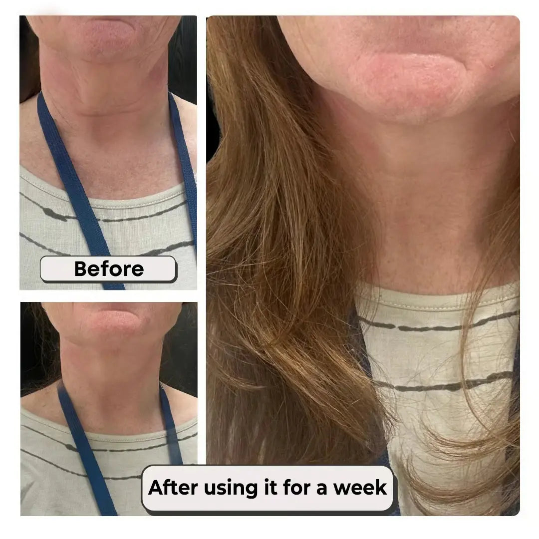 Instant Neck Lift & Wrinkle Tape