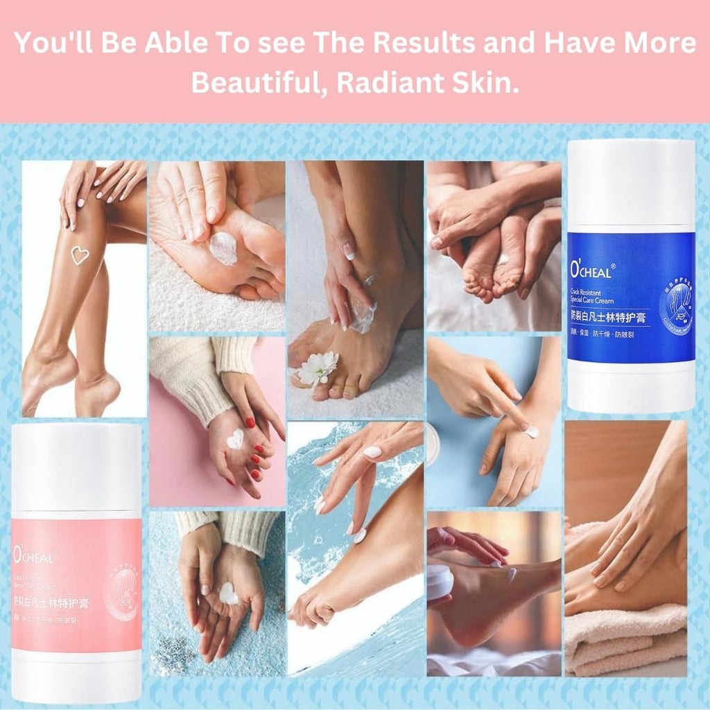 Anti-Drying Crack Cream for Foot, Hand & Lips