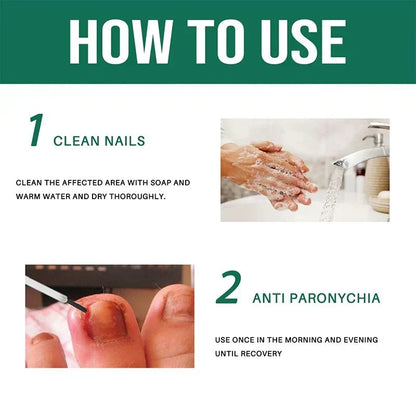 Anti Paronychia Relief Oil
