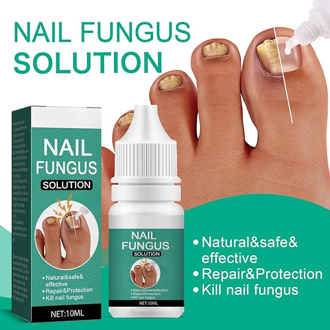 Nexusdrop Nail Fungus Solution