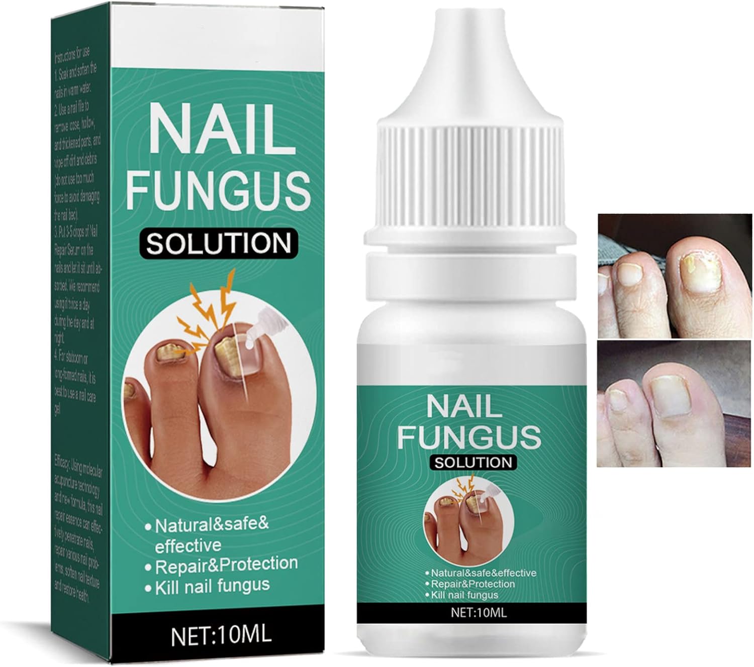 Nexusdrop Nail Fungus Solution