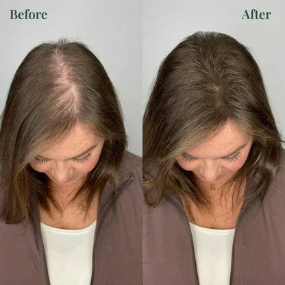 Kerarose Rosemary Shampoo For Hair Growth