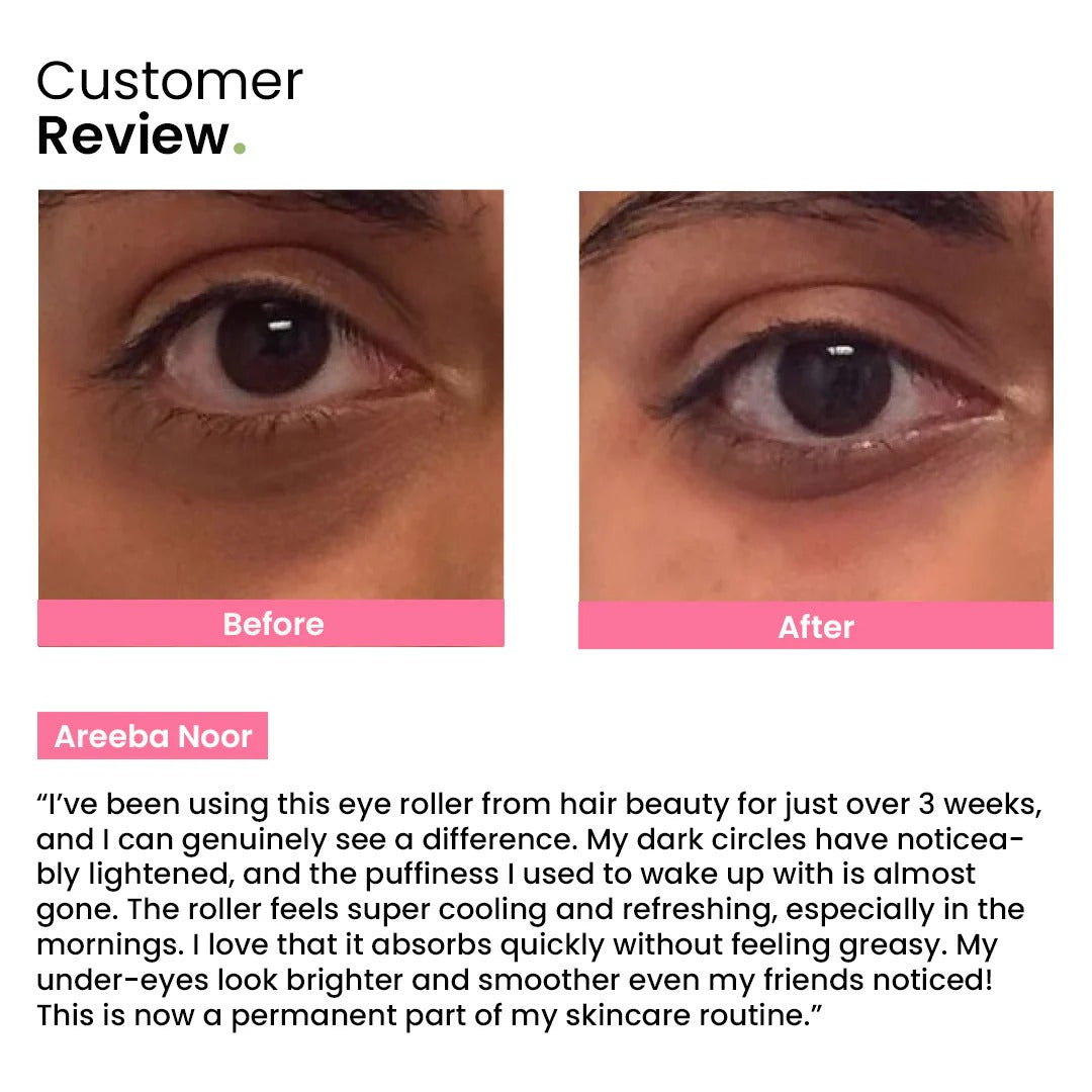 Anti-Dark Circle Eye Roller
